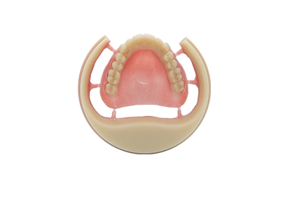 dental implant material cost