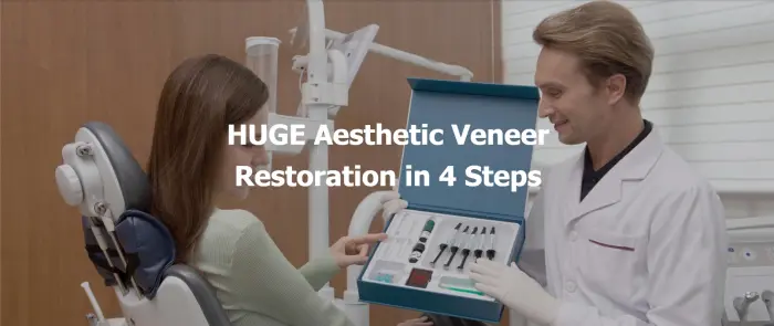 HUGE Aesthetic Veneer Restoration in 4 Steps