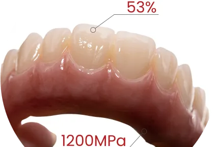 Full-Arch Ready. Esthetics Included.  See MM-4D Zirconia in Real Clinical Cases
